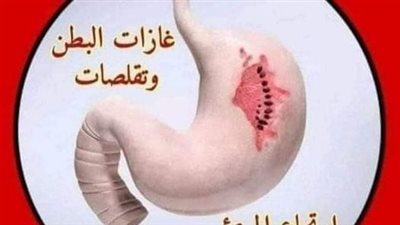 أعراض لبقولون 