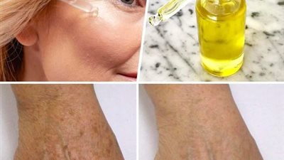 عمل سيروم للبشرة بفيتامين سي للعناية بنفسك