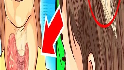 علامات تدل أن لديك اضطرابات في الغدة الدرقية