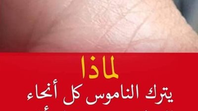 لماذا يقرص الناموس بعض الناس أكثر من البعض الآخر ؟