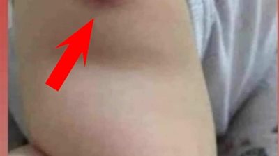 7 تغيرات تطرأ على جسمك بعد عمر الثلاثين.. منها صغر حجم الدماغ