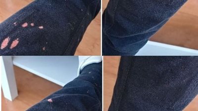 ١١ فكرة تساعدك في كيفية ازالة بقع الكلور من على الملابس