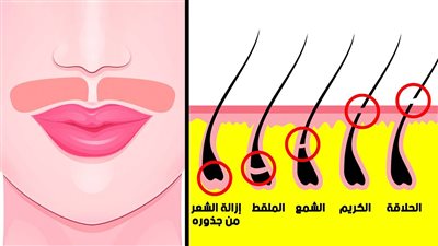 ازلة الشعر