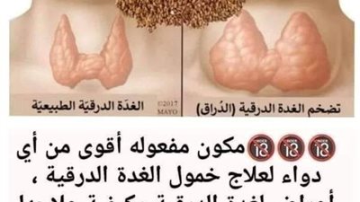 علاج خمول الغده بالاعشاب