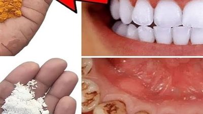 علاج الكحة المستمرة طبيعيا ومتى تستشير الطبيب؟