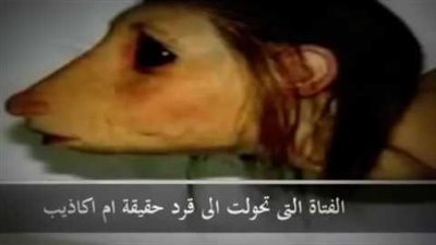 حقيقة الفتاة العمانية الممسوخة