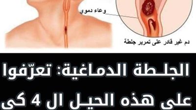 أحذر أعراض السكتة الدماغية عند الرجل وطرق الوقاية منها