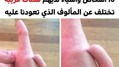 +10 أشخاص وأشياء لديهم سمات غريبة تختلف عن المألوف الذي تعودنا عليه