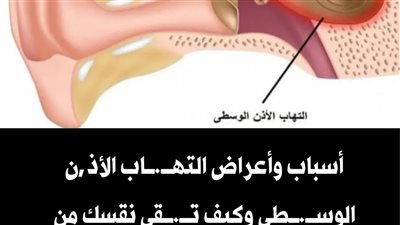 أسباب التهاب الأذن الوسطى وطرق العلاج