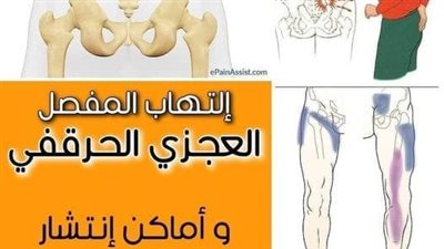 كيف تتخلص من آلام أسفل الظهر ؟