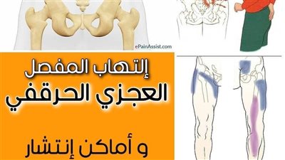 كيف تتخلص من آلام أسفل الظهر ؟