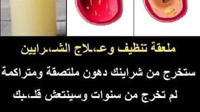 علاج انسداد الشرايين بمجموعة نصائح وطرق منزلية
