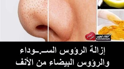 طريقة إزالة الرؤوس الســ.ــوداء والرؤوس البيضاء 