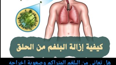 مشروبات علاج البلغم وطرده نهائياً بشكل مضمون وطبيعي