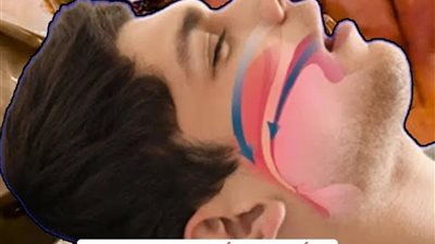 فوائد زيت القرنفل