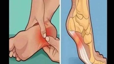كيفية التخلص من وعلاج ۏجع كعب الرجل