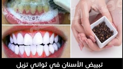 وصفات تلميع الأسنان تعلم كيفية تحضيرها بأفضل النتائج